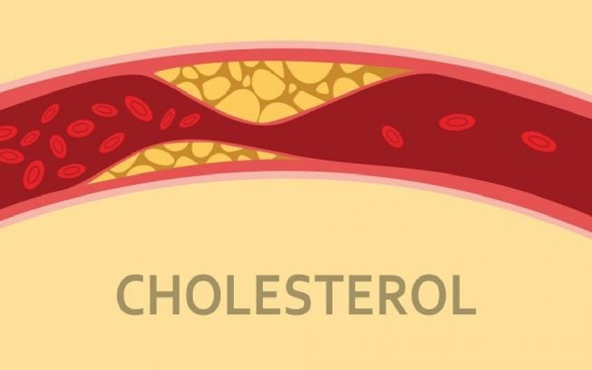 5 Daftar Buah yang Bisa Turunkan Kolestrol Dalam Tubuh