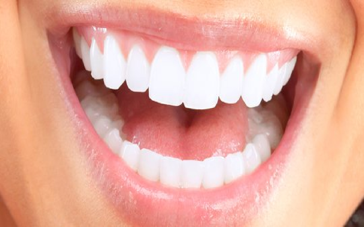 4 Tips Ampuh Putihkan Gigi yang Terlanjur Menguning, Tanpa Bau!