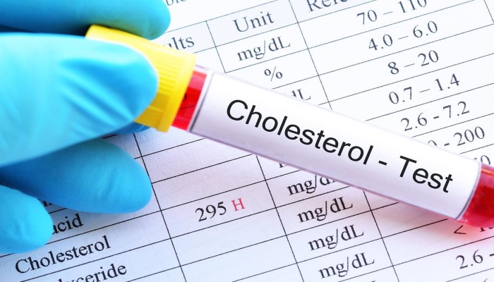 Waspada Kolesterol Naik Selama Libur Idul Adha, Catat 8 Tips Agar Tubuh Tetap Stabil!