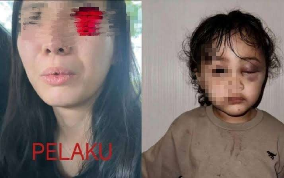 Polisi Ungkap Motif Suster yang Aniaya Anak Emy Aghnia