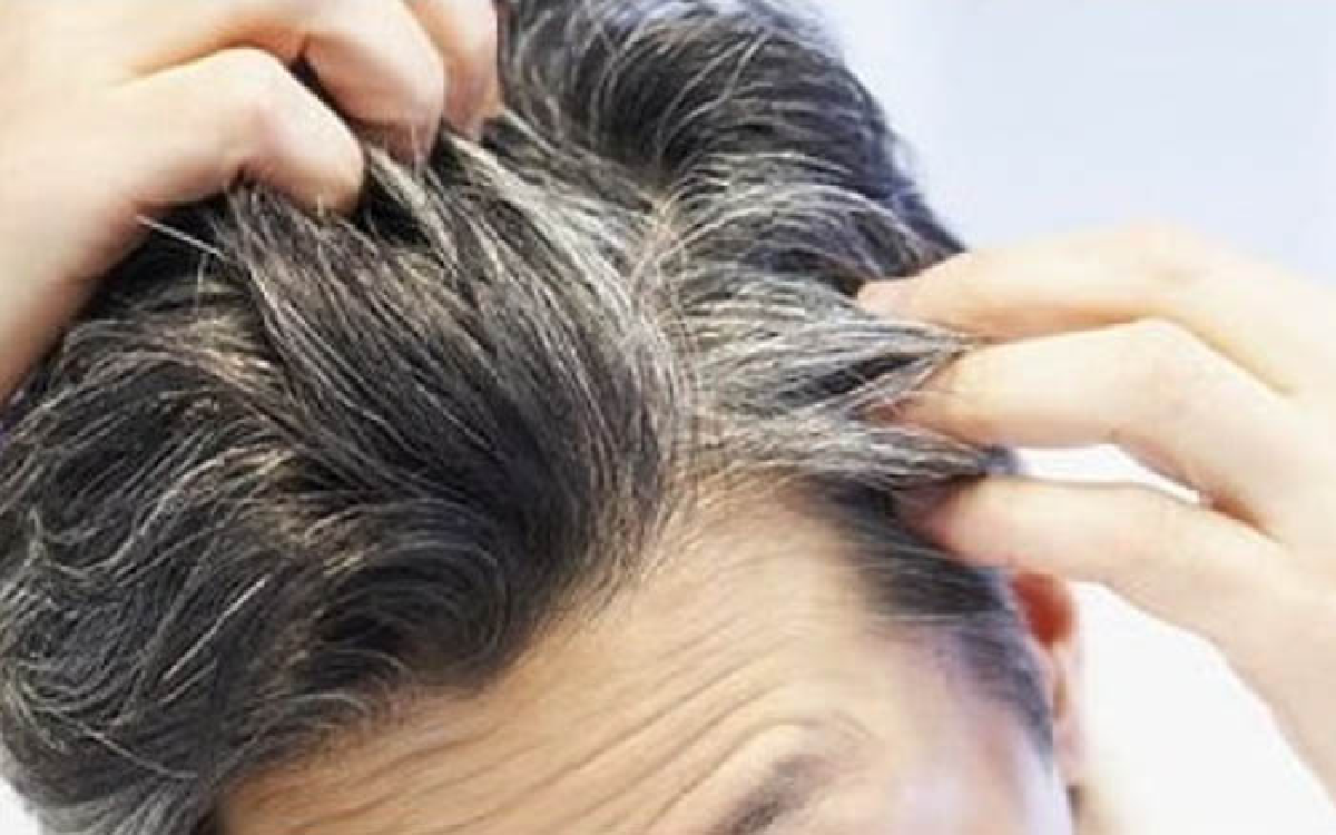 Malu Ubanan? Coba Beli Minyak Rambut Penghilang Uban Ini di Apotik, Cepat Hilang Tanpa Efek Samping