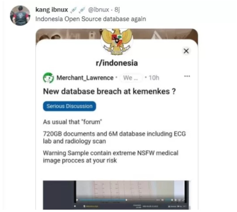 Edan! Diduga Ada Jutaan Data Pasien Covid-19 di Indonesia Bocor dan Dijualbelikan, Begini Tanggapan Kemenkes?
