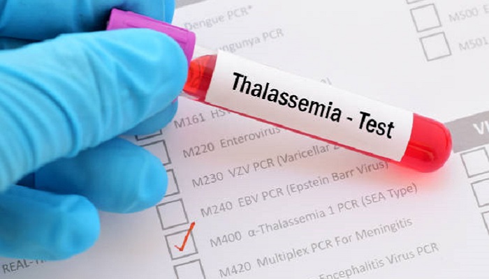 Cegah Penyebaran Thalassemia, Coba Cara Ini Sebelum Putuskan Menikah