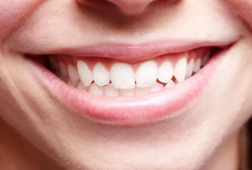 17 Bahan Alami yang Terbukti Mampu Merontokan Karang Gigi, Paling Ampuh dan Efektif!