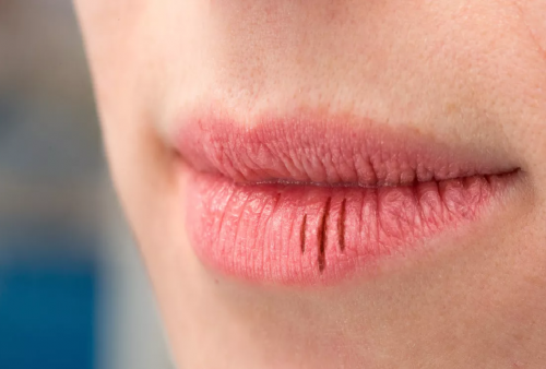3 Opsi Lipstik Paling Cocok untuk Hilangkan Bibir Kering