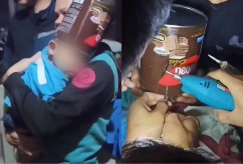 Viral di Media Sosial, Bocah 3 Tahun di Tasikmalaya Kepalanya Tersangkut Kaleng Biskuit! Damkar Langsung Turun Tangan