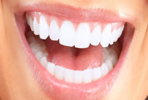 4 Tips Ampuh Putihkan Gigi yang Terlanjur Menguning, Tanpa Bau!