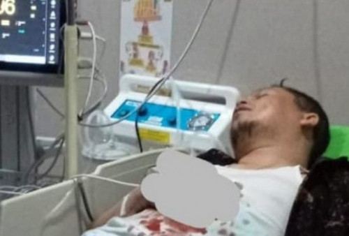Terkini! Pasca 2 Jarinya 'Hancur' Kena Ledakan Petasan, Wakil Bupati Kaur Segera Jalani Operasi di RS M Yunus