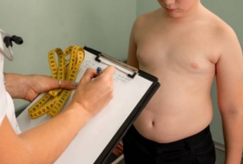 Simak Bun! Obesitas pada Anak Rentan Banyak Penyakit