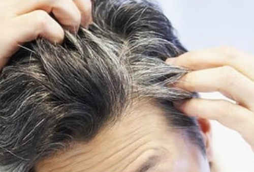 Malu Ubanan? Coba Beli Minyak Rambut Penghilang Uban Ini di Apotik, Cepat Hilang Tanpa Efek Samping