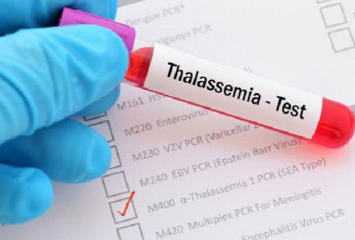 Cegah Penyebaran Thalassemia, Coba Cara Ini Sebelum Putuskan Menikah