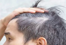 12 Rekomendasi Bahan Alami Penghilang Uban, Rambut Hitam Pekat Tanpa Takut Rontok!