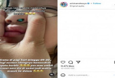 Ada-ada Saja Musibah! Anak YoungLex Masuk RS Hidungnya Kemasukan Sepatu Barbie