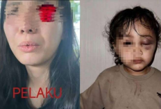 Polisi Ungkap Motif Suster yang Aniaya Anak Emy Aghnia