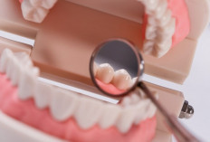 Catat! Ini yang Perlu Diperhatikan Sebelum Memasang Dental Implan